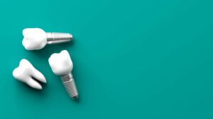 Why Choose Cream City Dental for Your Dental Implants?