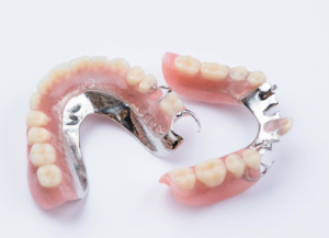 Do I Need Complete or Partial Dentures?