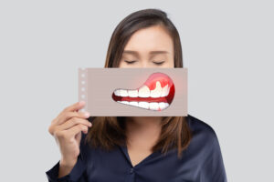 What Are the Warning Signs of Gum Disease?